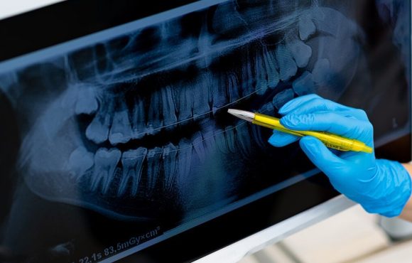 modern-digital-radiology-stomatology-teeth-dentistry-x-ray-examination_20-1080x648